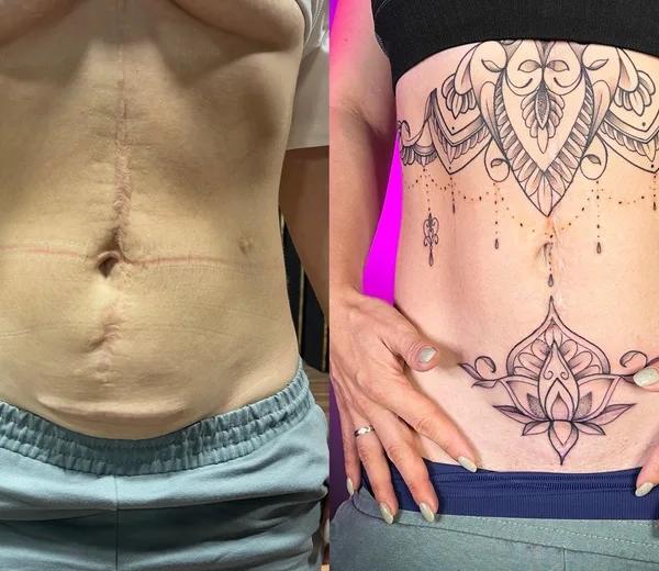 female black ornamental татуировка на stomach #58836 | Тату мастер Дмитрий Палкин