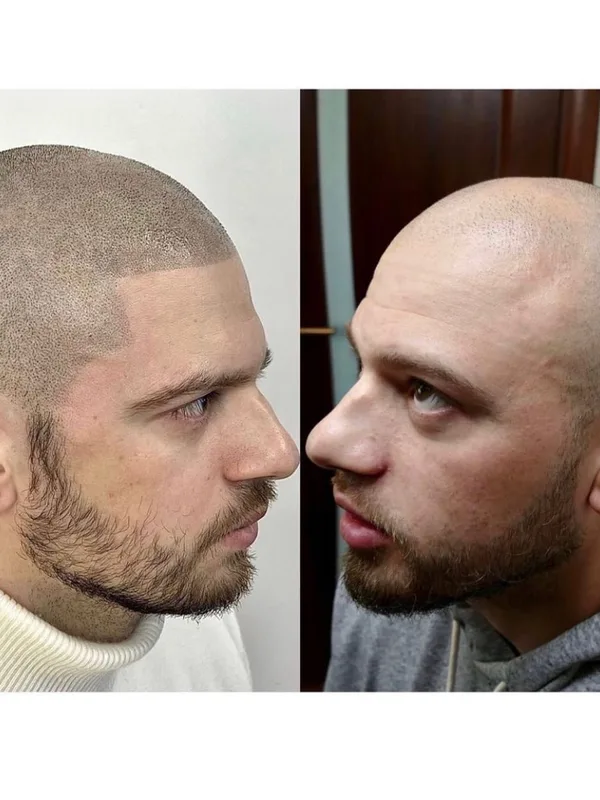male black blackwork Tatuaggio su scalp #54700 | Tatuatore Андрей Афанасьев