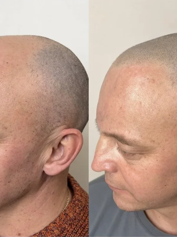 male black blackwork Tatuaggio su face #54690 | Tatuatore Андрей Афанасьев