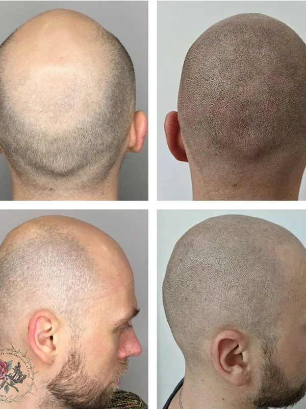 male black blackwork Tatuaggio su head #54697 | Tatuatore Андрей Афанасьев