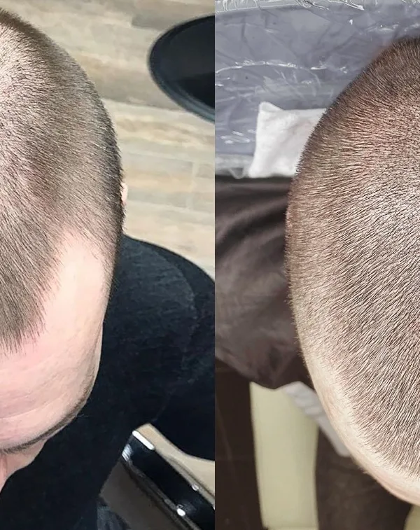 male black and grey micro realism Tatuaggio su head #54695 | Tatuatore Андрей Афанасьев