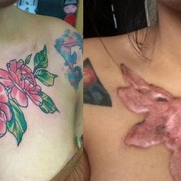 Можно ли удалить тату в домашних условиях?