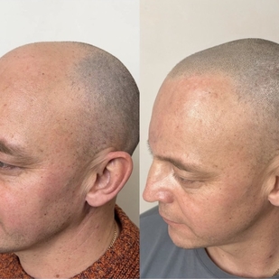 татуировка #54690 | Тату мастер Андрей Афанасьев