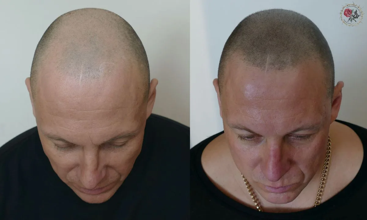 head hair tattoo photo