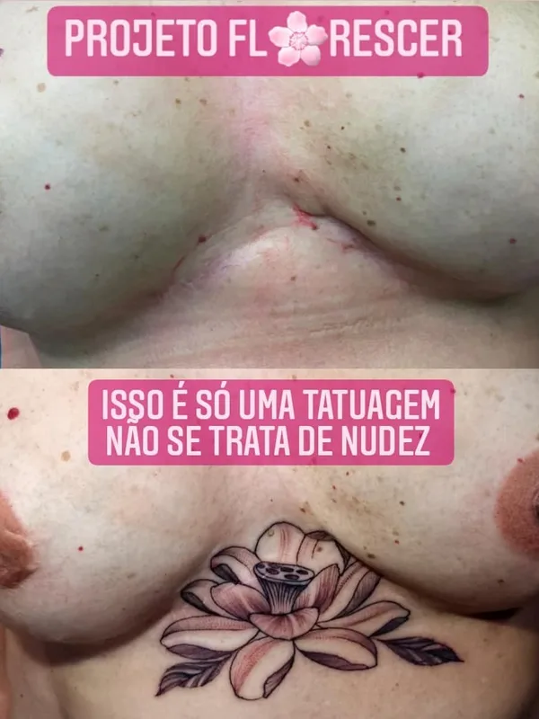 female black and grey blackwork татуировка на chest #46458 | Тату мастер Rodrigo Catuaba