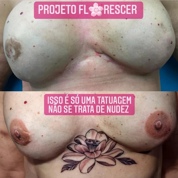 Blackwork Flower, Lotus tattoo on Chest