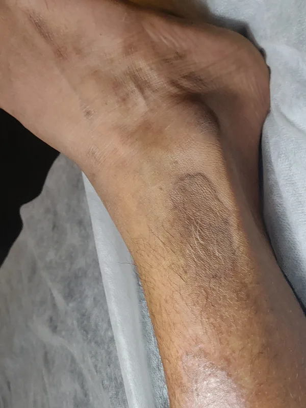 black and grey Tatuaggio su ankle #91487 | Tatuatore Mini Patankar