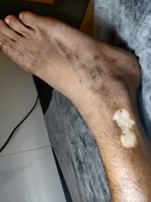 black and grey Tatuaggio su ankle #91493 | Tatuatore Mini Patankar
