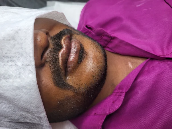 Micro Realism tattoo on Face