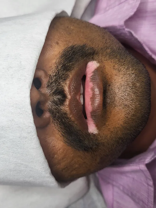 color Tatuaggio su face #91496 | Tatuatore Mini Patankar
