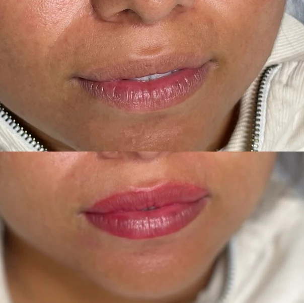 Micro Realism Lips tattoo on Face
