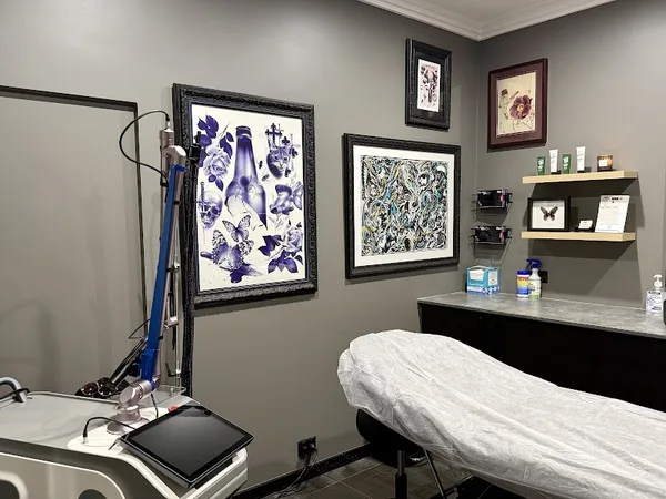 Renegade Tattoo Removal