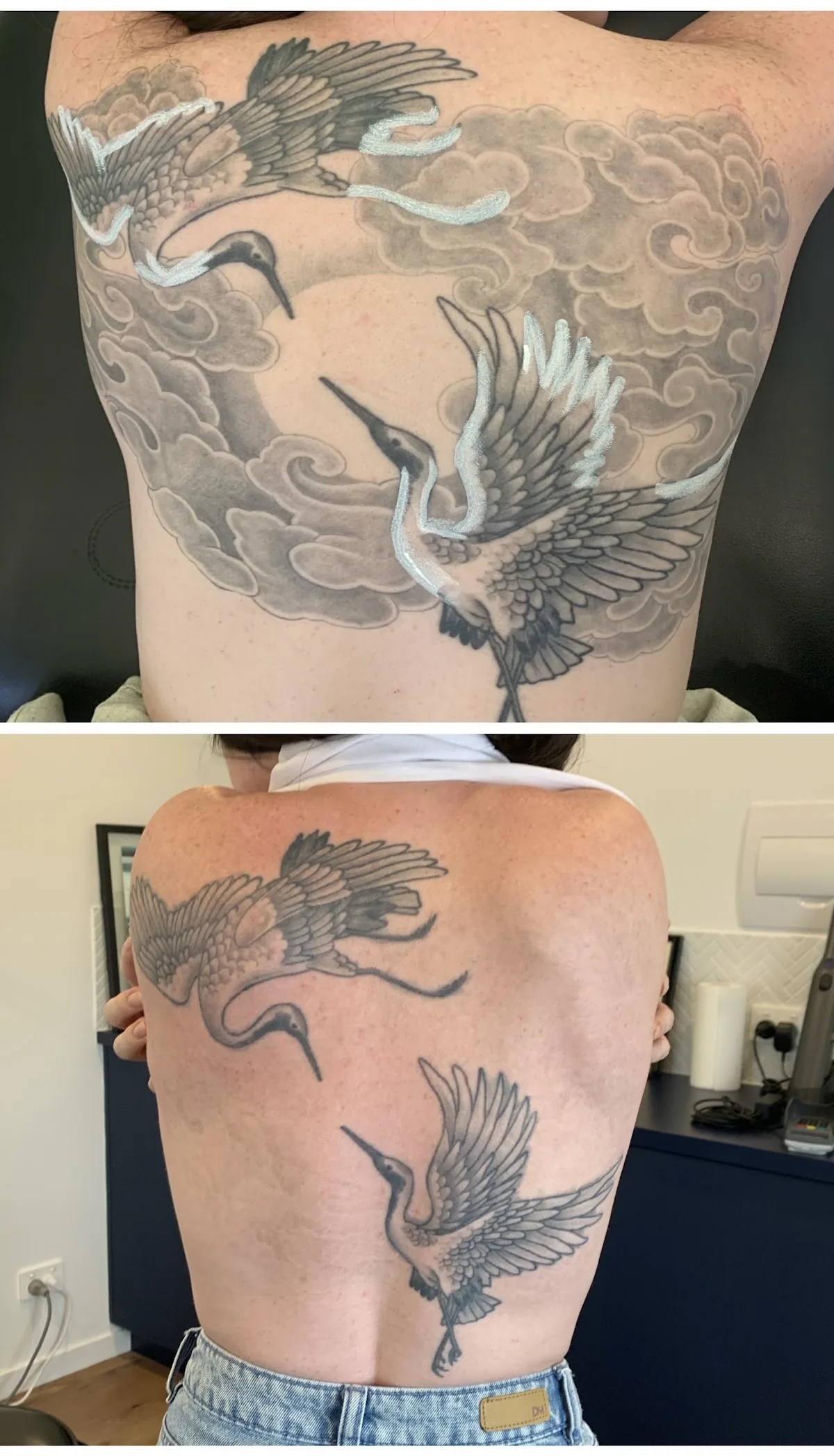 Tattoo by Counterpunch Tattoo Removal at Counterpunch Tattoo Removal