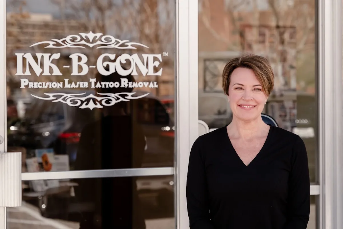 Tattoo by INK B GONE Tattoo Removal Denver at INK B GONE Tattoo Removal Denver