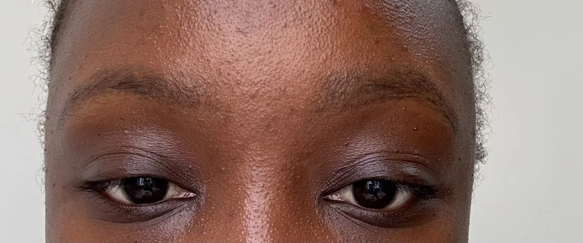 Tattoo by Inkless is More, Nairobi Laser Tattoo Removal Studio at Inkless is More, Nairobi Laser Tattoo Removal Studio