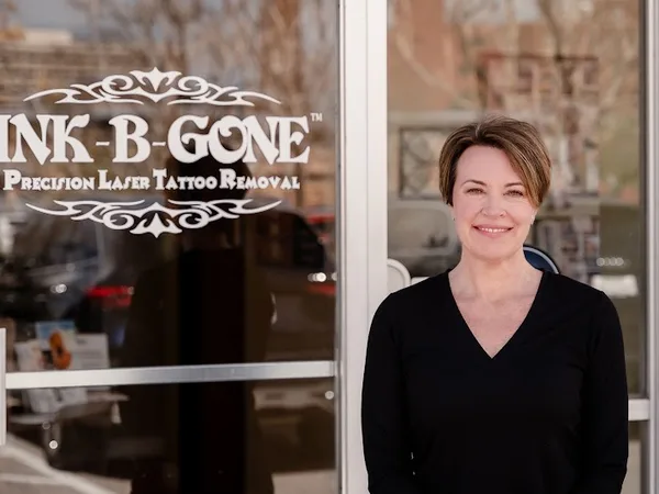 INK B GONE Tattoo Removal Denver