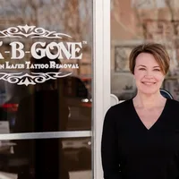 INK B GONE Tattoo Removal Denver