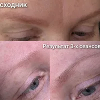 Tatu.net, студия удаления татуировок и татуажа