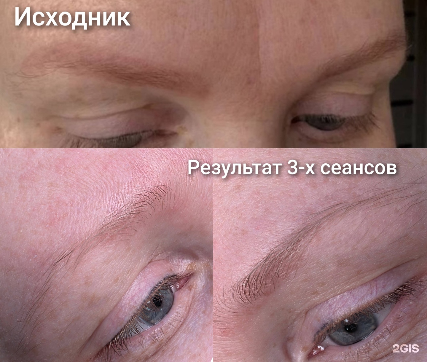 Tatu.net, студия удаления татуировок и татуажа