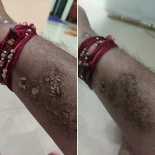 tattoo #91479 | Tattoo Artist Mini Patankar