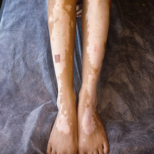 tattoo #91483 | Tattoo Artist Mini Patankar