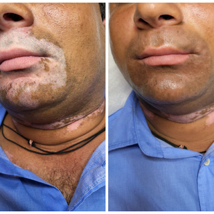 tattoo #91486 | Tattoo Artist Mini Patankar