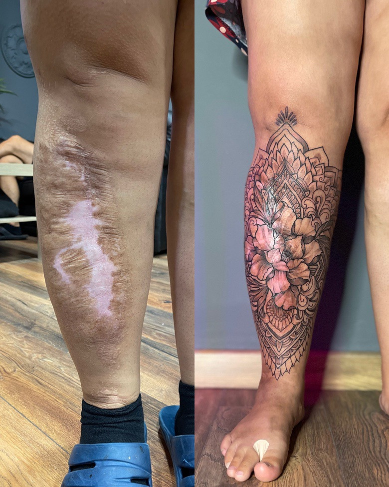 перекрытие шрамов татуировкой - мастер Дмитрий Палкин