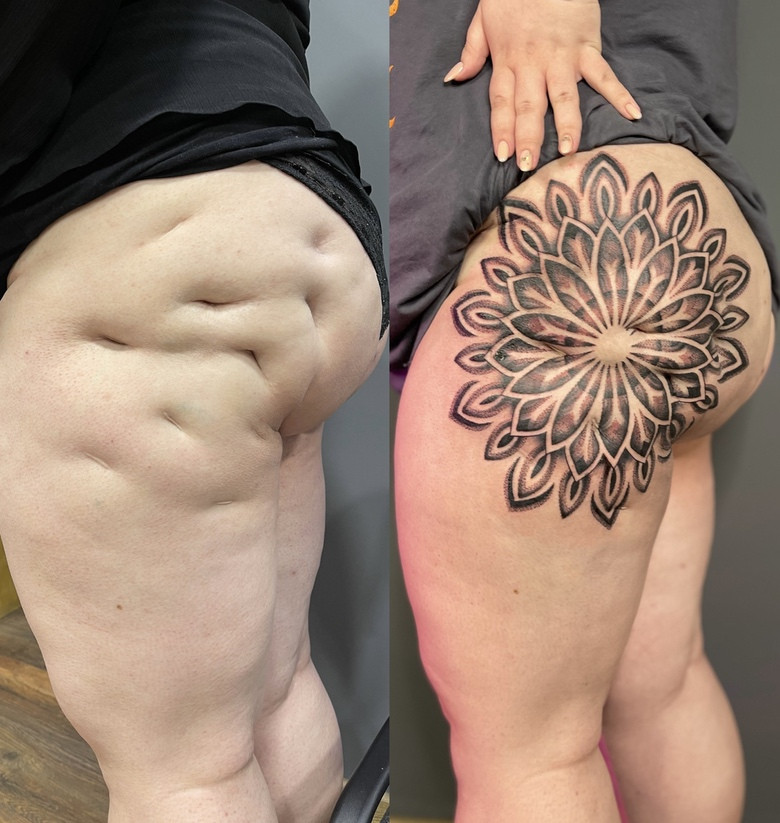  маскировка шрама татуировкой - Дмитрий Палкин 