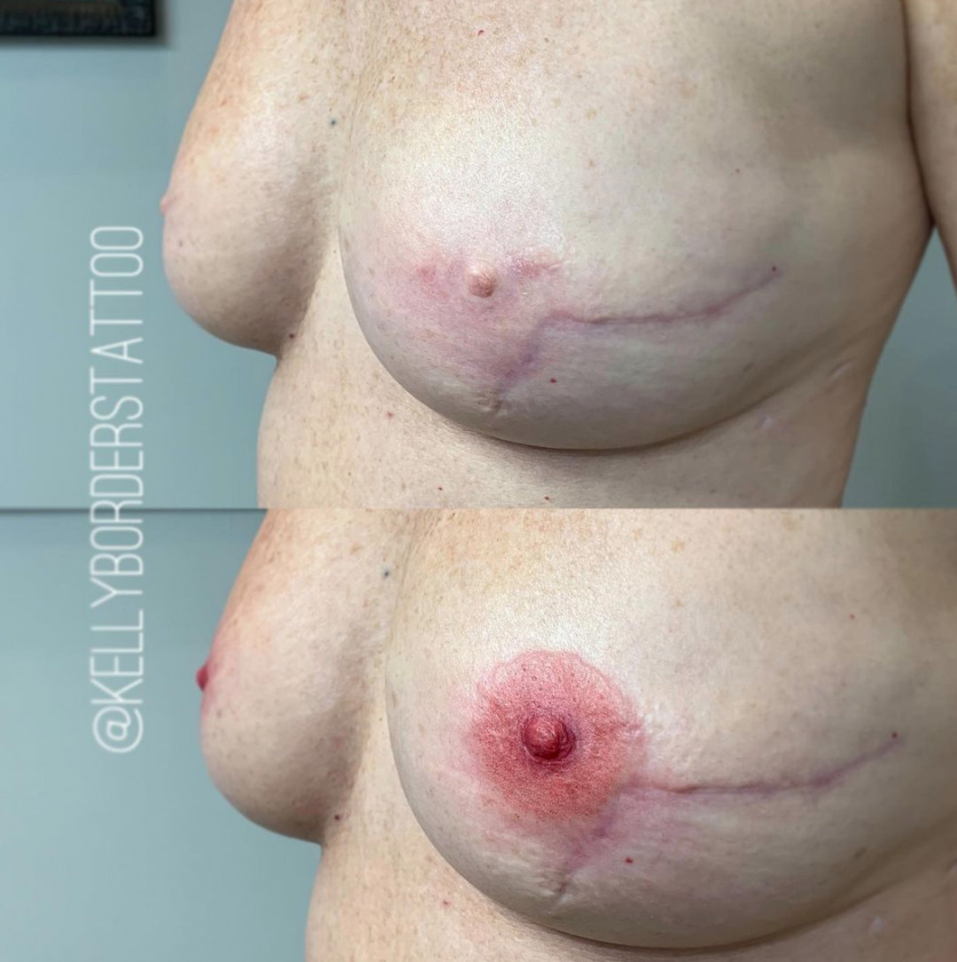 Tattoo artist Kelly Borders, Honor and Grace shop, restorative tattoo, American Traditional Tattoo, nipple tattoo, Areola Restorative Tattooing