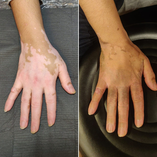 tatuaje #91478 | Tattoo Artist Mini Patankar