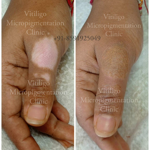 tatuaje #91480 | Tattoo Artist Mini Patankar