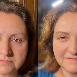 Fineline tatouage sur Visage #97702 | Artiste tatoueur Florence pham