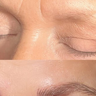 Femme  Fineline tatouage sur Visage #97706 | Artiste tatoueur Florence pham