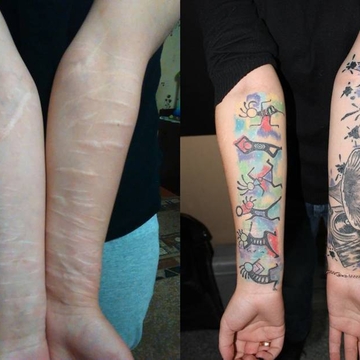 Lesioni e Tatuaggi: Tutto ciò che devi sapere per coprire una lesione