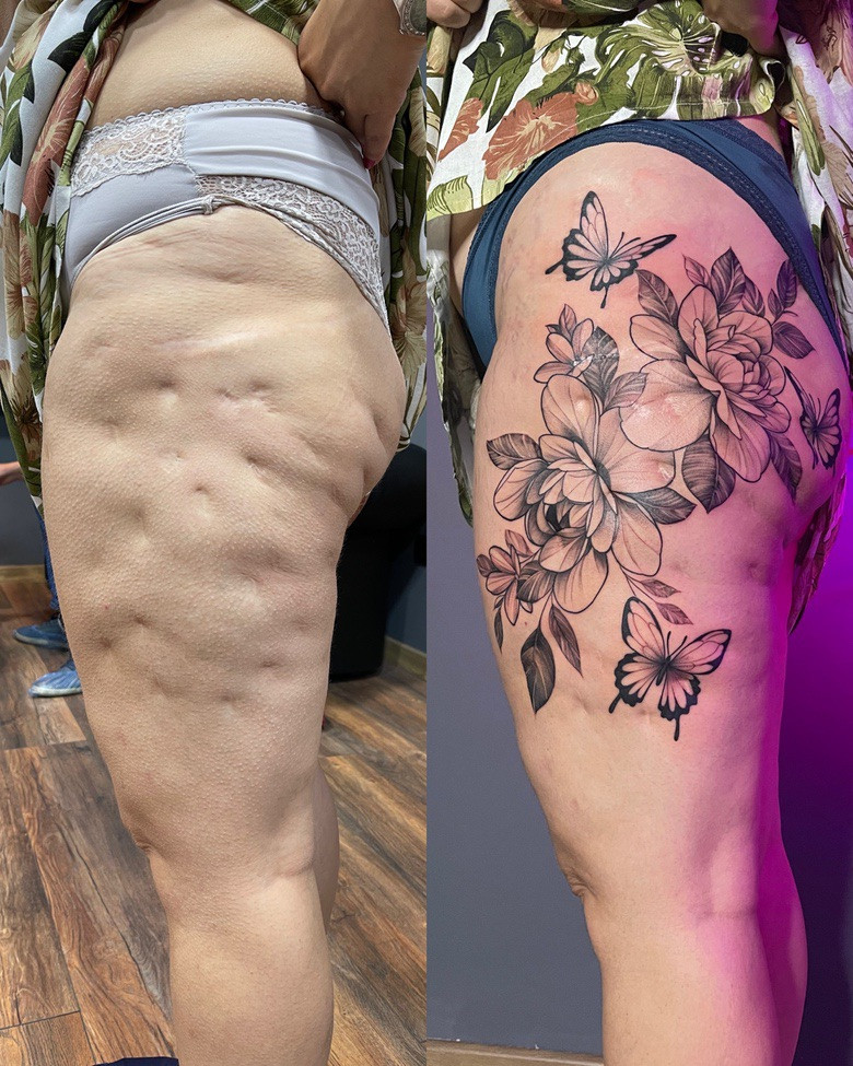 перекрытие шрамов татуировкой - мастер Дмитрий Палкин