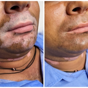 Mini Patankar | Mumbai, India | iNKPPL