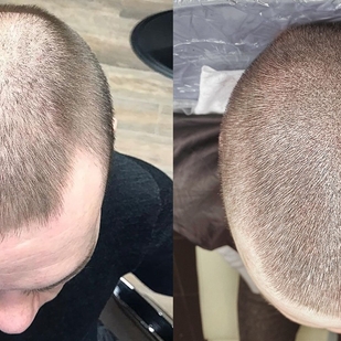 🔥 핫 포토, 모델 포트폴리오  #54695 타투이스트 Andrey Afanasev