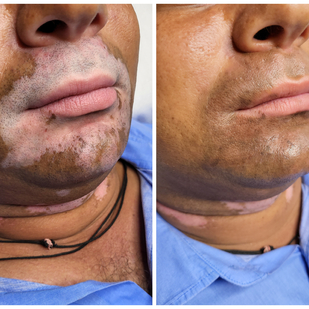 🔥 Fotos quentes, portfólio de modelos  #91485 Artista de tatuagem Mini Patankar