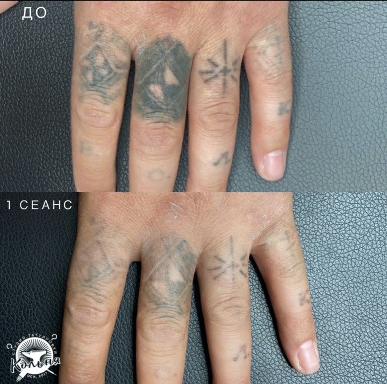 пример удаления жженки