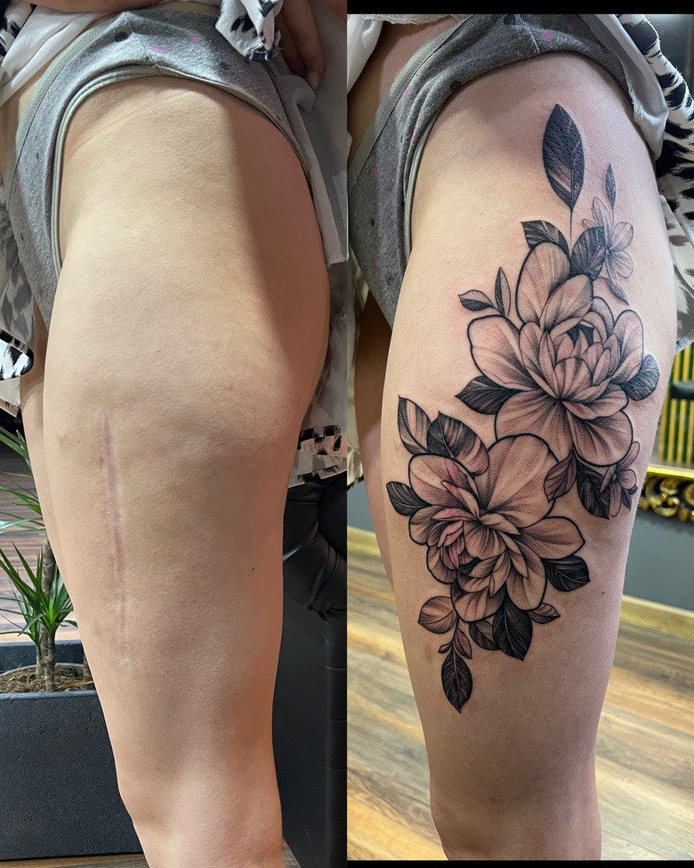  маскировка шрама татуировкой - Дмитрий Палкин 