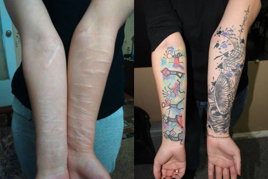 Татуировка на шраме на груди - искусство, символика и безопасность
