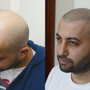 🔥 热门照片、模特作品集  #54692 纹身师 Andrey Afanasev